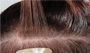 5-extension-adesive-guida-alla-scelta-1